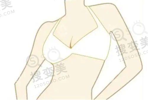 重庆松山医院隆鼻实例分享:医院资质可靠,环境舒适宜人