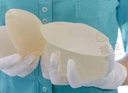 重庆松山医院眼科主事秦伟双眼皮修复好，价格优惠性价比高