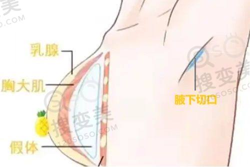 重庆松山医院做鼻子怎么样?段艳军技术优势尽显
