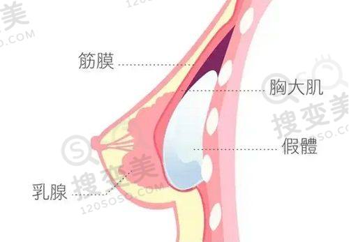 重庆松山整形医院吸脂多少钱?徐铎等医生多部位吸脂7900元起成效优之选择理由分析