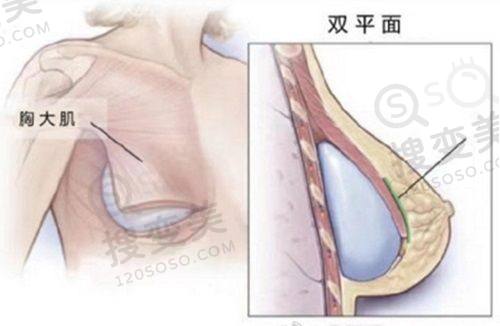岳阳普瑞缇医疗美容门做隆鼻价格表,Chloe原生定制鼻5800 - 25800元