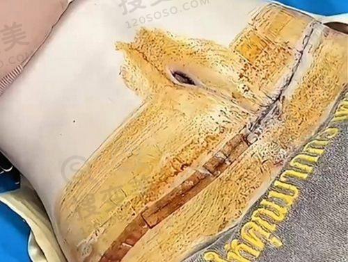 重庆松山医院体检中 心电话号码:松山医院体检中 心24小时询问+预约方式——地理位置及交通