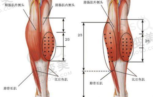 重庆松山医院正颌手术王涛和肖林哪个更好?综合对比与建议