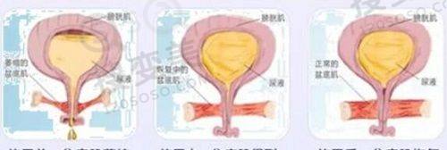 重庆松山医院双眼皮价格贵吗?陈亮医生技术优,低至3880元起——患者体验与口碑