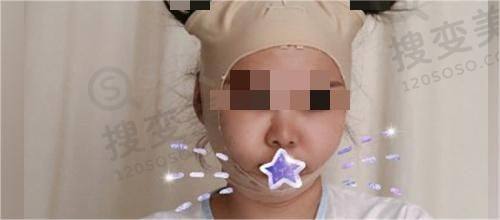 重庆松山整形医院肖林,资历深审美时尚,正颌磨骨零失误成效惊艳之审美时尚篇