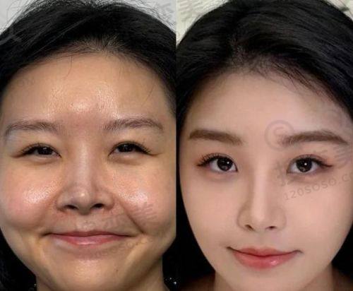 重庆松山医院的优势及肖林医生的特色