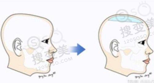 重庆松山医院体检中 心电话号码:松山医院体检中 心24小时询问+预约方式——体检注意事项