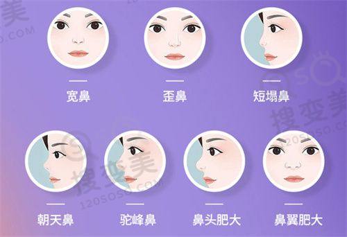 重庆松山医院磨骨手术的优势与选择理由