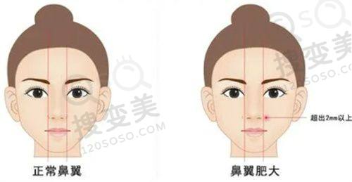 重庆松山医院做鼻子怎么样?李喆技术实力不凡