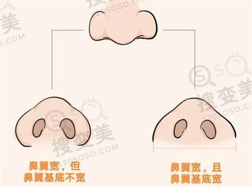 重庆松山医院磨骨医生牛!如何选择适合自己的医生成效好,口碑佳