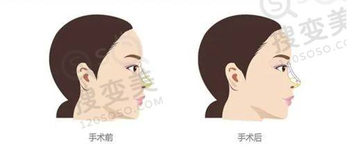 烟台三有整形美容医院隆鼻价格——医生团队与技术