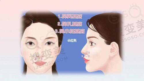 重庆松山医院正颌价格揭秘!肖林医生技术优,6 - 12万性价比高可预约——肖林医生个人简介