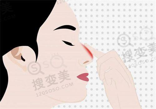 重庆松山医院整形科收费标准揭秘！肖林医生轮廓手术优势突显