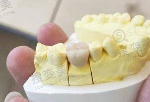 9、成都锦江科瓦口腔(人东店)真人口碑评价怎么样？