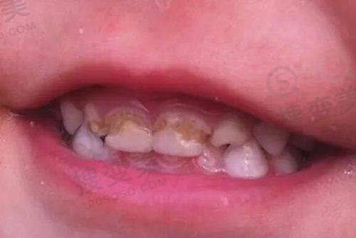 4、东莞雅皓口腔门诊部特色项目及技术优势