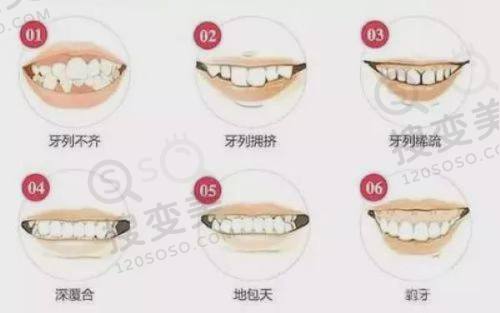 4、郑州博奥口腔医院特色项目及技术优势
