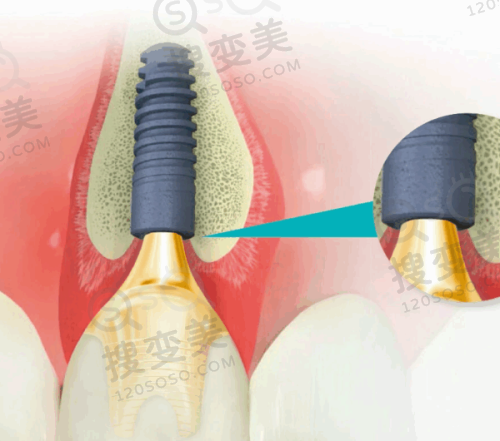 3、郑州博奥口腔医院简介概述