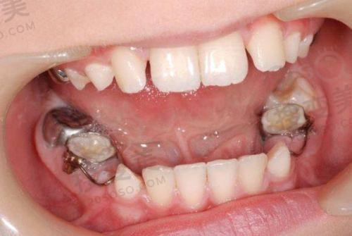 4、安溪联宇口腔门诊部特色项目及技术优势