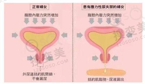 重庆松山医院正颌大夫揭秘！肖林/王涛技术强，价格透明实例棒——王涛医生的独特技术