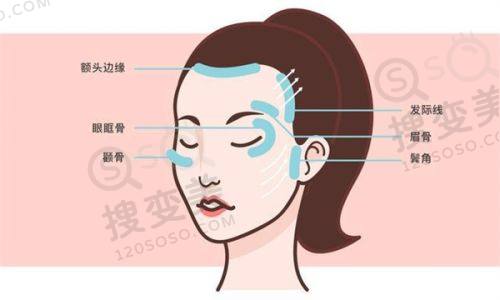 重庆松山医院隆鼻多少钱?肋软骨隆鼻技术好创伤小,价格23000 - 47000元——肋软骨隆鼻技术优势