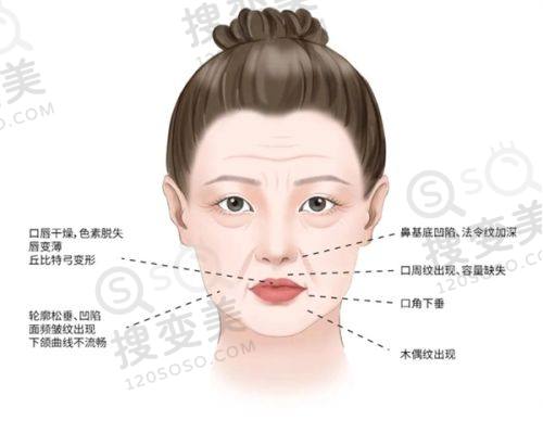 重庆松山医院双眼皮价格贵吗?陈亮医生技术优,低至3880元起——双眼皮手术价格分析