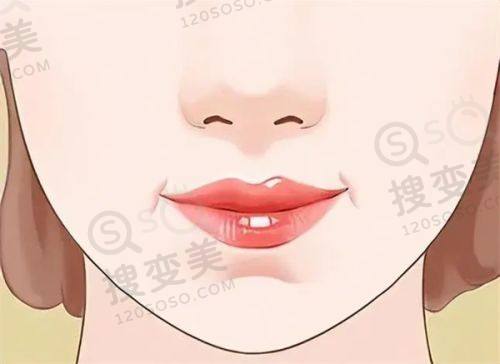 重庆松山整形医院是渠道医院吗？正规可靠磨骨正颌技术优，口碑良好——磨骨正颌技术优势
