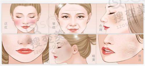 重庆松山医院眼科主事秦伟双眼皮修复好，眼科出身优势明显