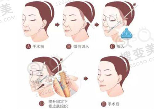 重庆松山医院面部轮廓手术优势：3级资质打造理想轮廓