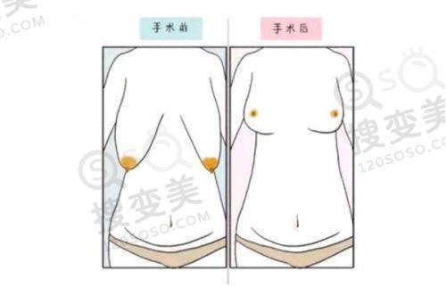 淮安苏王整形医院做皮肤激光价格之嫩肤费用详情