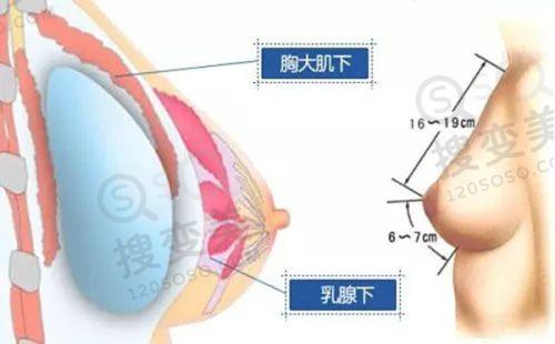 重庆松山医院磨骨手术费用多少?夏德林磨骨技术优,价1万起可预约