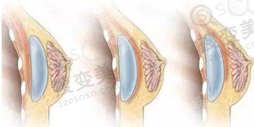 常州星空医疗美容做隆鼻价格——与其他医院对比