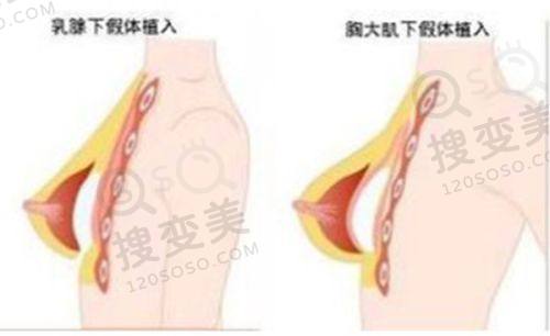 沈阳汇禾医疗美容双眼皮修复价格表之张鹏医生相关