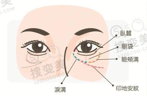 重庆松山医院整形科收费标准揭秘！正颌/轮廓手术价格及肖林等医生优势全知晓 