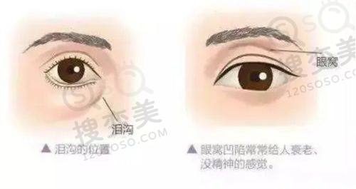 沈阳汇禾医疗美容双眼皮修复价格表之杨睿医生相关