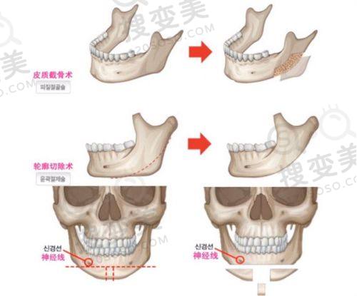 重庆松山医院院长是谁？李喆筋膜提升“网格锚定术”，真人案例效果惊艳 