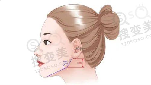 潮州柏蕾医疗美容诊所做隆胸价格多少钱——假体隆胸180cc价格