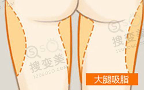 丹阳薇塔贝拉医疗美容诊所口碑评价