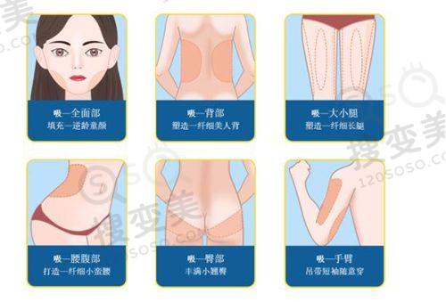重庆松山医院双眼皮修复价格多少?综合优势突出,值得信赖之选