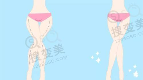 重庆松山医院做双眼皮怎么样？孙刚自然无痕、秦伟精细修复获患者称赞