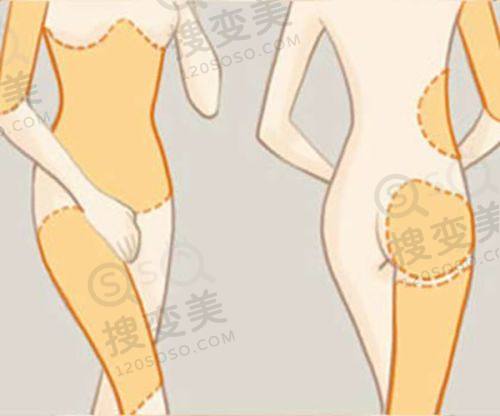 北京圣嘉荣整形医院口碑与预约情况