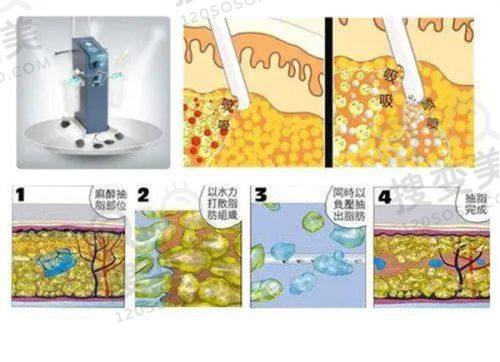 重庆肖林是几级医生?不是一级医生,磨骨正颌术中操作精细