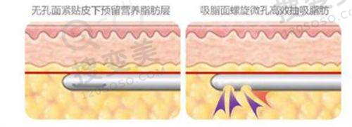 重庆松山整形医院朱乐林医生手术失败是假，磨骨成效好口碑高无事故之术前评估