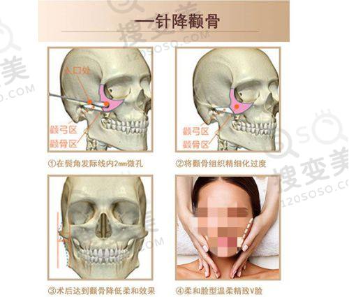 烟台三有整形美容医院隆鼻价格多少?正规医院收费透明,效果超赞口碑好