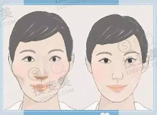 重庆松山医院是国有么?是私立但特别正规且正颌手术技术好——正颌手术收费合理性