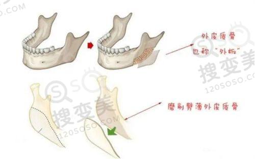 乌鲁木齐李咏梅医疗美容价格表之与其他医院价格对比