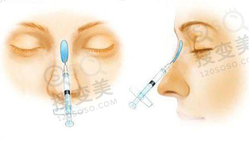重庆松山医院口腔科治疗牙齿费用多少?洗牙69起正颌7 - 12万,技术优口碑好