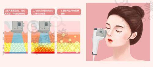 嘉兴禾美整形医院价格表之眼部整形项目收费