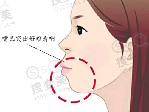 重庆松山医院眼科怎么样?兰宇/秦伟/段艳军综合实力铸就技术优,口碑好