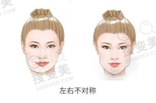 重庆松山医院双眼皮修复怎么样？兰宇/段艳军妙手回春，真人实例见证成效——真人实例见证神奇成效