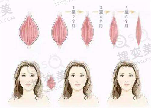 重庆松山医院隆鼻手术费用:李喆高难度鼻修复技术棒,还享免费福利可约